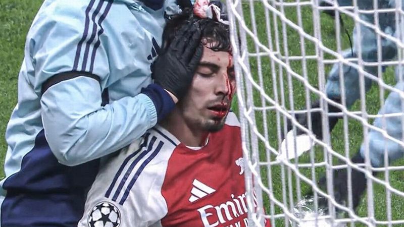Mikel Arteta fait le point sur la blessure à la tête de Kai Havertz et ses saignements abondants